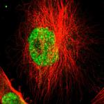 SUGP1 Antibody in Immunocytochemistry (ICC/IF)