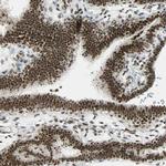 SUGP1 Antibody in Immunohistochemistry (Paraffin) (IHC (P))