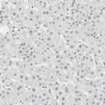 SUGP1 Antibody in Immunohistochemistry (Paraffin) (IHC (P))