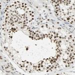 SUGP1 Antibody in Immunohistochemistry (Paraffin) (IHC (P))