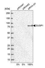 SUGP1 Antibody in Western Blot (WB)