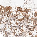 PTPN22 Antibody in Immunohistochemistry (Paraffin) (IHC (P))