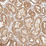 PTPN22 Antibody in Immunohistochemistry (Paraffin) (IHC (P))