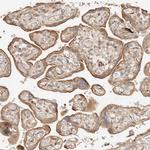 PTPN22 Antibody in Immunohistochemistry (Paraffin) (IHC (P))