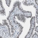 ARID1A Antibody in Immunohistochemistry (IHC)