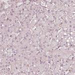 FMNL2 Antibody in Immunohistochemistry (Paraffin) (IHC (P))