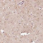 FMNL2 Antibody in Immunohistochemistry (IHC)