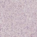 FMNL2 Antibody in Immunohistochemistry (IHC)