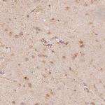 FMNL2 Antibody in Immunohistochemistry (IHC)