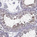 Gemin 3 Antibody in Immunohistochemistry (IHC)