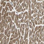 KANK1 Antibody in Immunohistochemistry (Paraffin) (IHC (P))