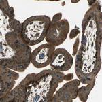 KANK1 Antibody in Immunohistochemistry (Paraffin) (IHC (P))