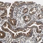 CECR5 Antibody in Immunohistochemistry (Paraffin) (IHC (P))