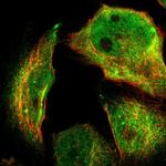 SKAP2 Antibody in Immunocytochemistry (ICC/IF)