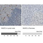 SKAP2 Antibody in Immunohistochemistry (IHC)