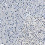 SKAP2 Antibody in Immunohistochemistry (IHC)