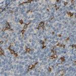 SKAP2 Antibody in Immunohistochemistry (IHC)