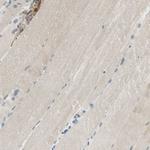 SDF2L1 Antibody in Immunohistochemistry (Paraffin) (IHC (P))