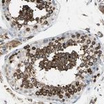 SDF2L1 Antibody in Immunohistochemistry (Paraffin) (IHC (P))