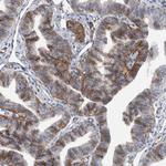 BCAM Antibody in Immunohistochemistry (Paraffin) (IHC (P))