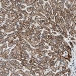 PRELID1 Antibody in Immunohistochemistry (Paraffin) (IHC (P))