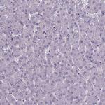 FOXJ1 Antibody in Immunohistochemistry (Paraffin) (IHC (P))