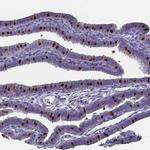 FOXJ1 Antibody in Immunohistochemistry (IHC)