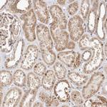 USP33 Antibody in Immunohistochemistry (Paraffin) (IHC (P))