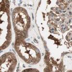 GALT Antibody in Immunohistochemistry (IHC)