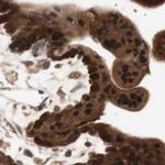 GALT Antibody in Immunohistochemistry (IHC)