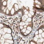 GALT Antibody in Immunohistochemistry (IHC)