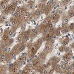 GALT Antibody in Immunohistochemistry (IHC)