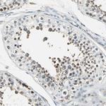 USP40 Antibody in Immunohistochemistry (Paraffin) (IHC (P))