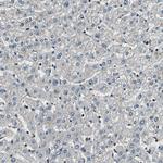 eIF2b beta Antibody in Immunohistochemistry (Paraffin) (IHC (P))