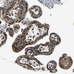 eIF2b beta Antibody in Immunohistochemistry (Paraffin) (IHC (P))