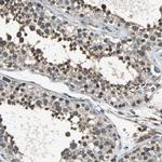 eIF2b beta Antibody in Immunohistochemistry (Paraffin) (IHC (P))