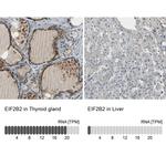 eIF2b beta Antibody in Immunohistochemistry (IHC)