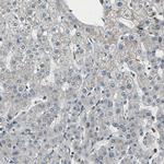 eIF2b beta Antibody in Immunohistochemistry (IHC)