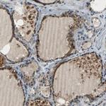 eIF2b beta Antibody in Immunohistochemistry (IHC)