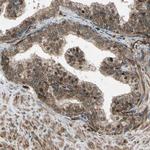 EXD2 Antibody in Immunohistochemistry (Paraffin) (IHC (P))