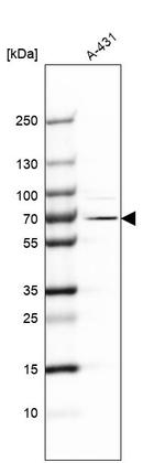 EXD2 Antibody in Western Blot (WB)