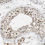 ELOA Antibody in Immunohistochemistry (Paraffin) (IHC (P))