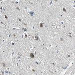 MCT2 Antibody in Immunohistochemistry (Paraffin) (IHC (P))