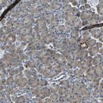 MCT2 Antibody in Immunohistochemistry (Paraffin) (IHC (P))