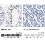 AKAP4 Antibody in Immunohistochemistry (IHC)