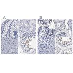 AKAP4 Antibody in Immunohistochemistry (IHC)