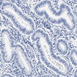 AKAP4 Antibody in Immunohistochemistry (IHC)