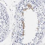 AKAP4 Antibody in Immunohistochemistry (IHC)