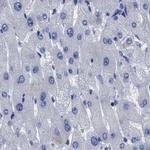 AKAP4 Antibody in Immunohistochemistry (IHC)