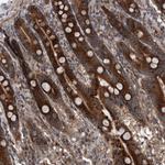 SERC2 Antibody in Immunohistochemistry (Paraffin) (IHC (P))